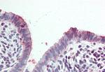 STEAP2 Antibody in Immunohistochemistry (Paraffin) (IHC (P))