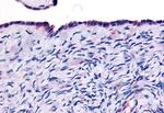 THRA Antibody in Immunohistochemistry (Paraffin) (IHC (P))