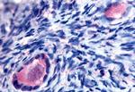 TMEM5 Antibody in Immunohistochemistry (Paraffin) (IHC (P))