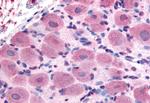 TRPA1 Antibody in Immunohistochemistry (Paraffin) (IHC (P))