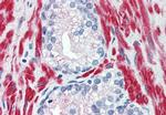 TRPM8 Antibody in Immunohistochemistry (Paraffin) (IHC (P))