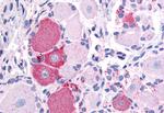 TRPV2 Antibody in Immunohistochemistry (Paraffin) (IHC (P))