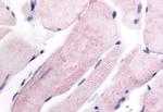 WNK1 Antibody in Immunohistochemistry (Paraffin) (IHC (P))