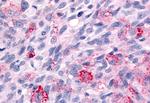 WNK1 Antibody in Immunohistochemistry (Paraffin) (IHC (P))