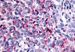 WNK1 Antibody in Immunohistochemistry (Paraffin) (IHC (P))