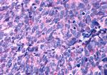 HTR2B Antibody in Immunohistochemistry (Paraffin) (IHC (P))