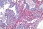 AGTR2 Antibody in Immunohistochemistry (Paraffin) (IHC (P))