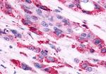 AVPR2 Antibody in Immunohistochemistry (Paraffin) (IHC (P))