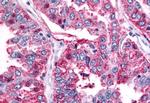 BAI2 Antibody in Immunohistochemistry (Paraffin) (IHC (P))