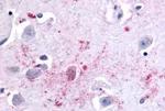 BAI2 Antibody in Immunohistochemistry (Paraffin) (IHC (P))