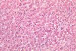 CALCRL Antibody in Immunohistochemistry (Paraffin) (IHC (P))