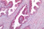 CALCRL Antibody in Immunohistochemistry (Paraffin) (IHC (P))