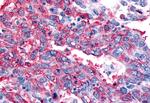 CALCRL Antibody in Immunohistochemistry (Paraffin) (IHC (P))