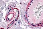 CALCRL Antibody in Immunohistochemistry (Paraffin) (IHC (P))