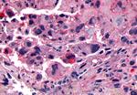 CALCRL Antibody in Immunohistochemistry (Paraffin) (IHC (P))