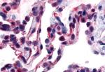 CALCRL Antibody in Immunohistochemistry (Paraffin) (IHC (P))