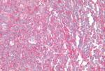 CCR6 Antibody in Immunohistochemistry (Paraffin) (IHC (P))