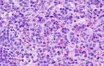 CCR7 Antibody in Immunohistochemistry (Paraffin) (IHC (P))