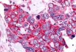 Cdc7 Antibody in Immunohistochemistry (Paraffin) (IHC (P))