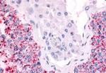 Cdc7 Antibody in Immunohistochemistry (Paraffin) (IHC (P))