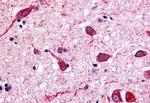 CHRM2 Antibody in Immunohistochemistry (Paraffin) (IHC (P))