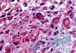 CHRM2 Antibody in Immunohistochemistry (Paraffin) (IHC (P))