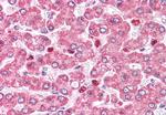 COMT Antibody in Immunohistochemistry (Paraffin) (IHC (P))