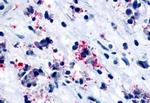 CYSLTR1 Antibody in Immunohistochemistry (Paraffin) (IHC (P))