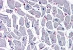 CYSLTR2 Antibody in Immunohistochemistry (Paraffin) (IHC (P))