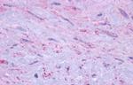 DRD1 Antibody in Immunohistochemistry (Paraffin) (IHC (P))