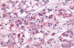 DRD1 Antibody in Immunohistochemistry (Paraffin) (IHC (P))