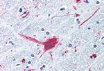 DRD3 Antibody in Immunohistochemistry (Paraffin) (IHC (P))