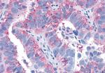 EDG3 Antibody in Immunohistochemistry (Paraffin) (IHC (P))