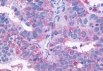 EDG3 Antibody in Immunohistochemistry (Paraffin) (IHC (P))