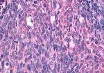 EDG3 Antibody in Immunohistochemistry (Paraffin) (IHC (P))