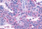 EDG3 Antibody in Immunohistochemistry (Paraffin) (IHC (P))