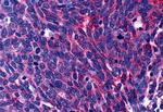 LPAR3 Antibody in Immunohistochemistry (Paraffin) (IHC (P))