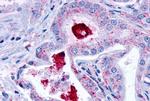 LPAR3 Antibody in Immunohistochemistry (Paraffin) (IHC (P))