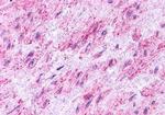 Endothelin B Receptor Antibody in Immunohistochemistry (Paraffin) (IHC (P))