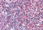 EMR2 Antibody in Immunohistochemistry (Paraffin) (IHC (P))