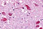 EMR2 Antibody in Immunohistochemistry (Paraffin) (IHC (P))