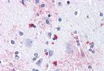 ENT1 Antibody in Immunohistochemistry (Paraffin) (IHC (P))