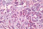 EphB2 Antibody in Immunohistochemistry (Paraffin) (IHC (P))