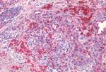 EphB2 Antibody in Immunohistochemistry (Paraffin) (IHC (P))