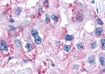 PAR2 Antibody in Immunohistochemistry (Paraffin) (IHC (P))