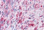 FZD1 Antibody in Immunohistochemistry (Paraffin) (IHC (P))