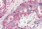 FZD4 Antibody in Immunohistochemistry (Paraffin) (IHC (P))