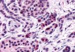 FZD5 Antibody in Immunohistochemistry (Paraffin) (IHC (P))