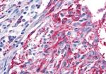 FZD5 Antibody in Immunohistochemistry (Paraffin) (IHC (P))