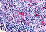 FZD8 Antibody in Immunohistochemistry (Paraffin) (IHC (P))